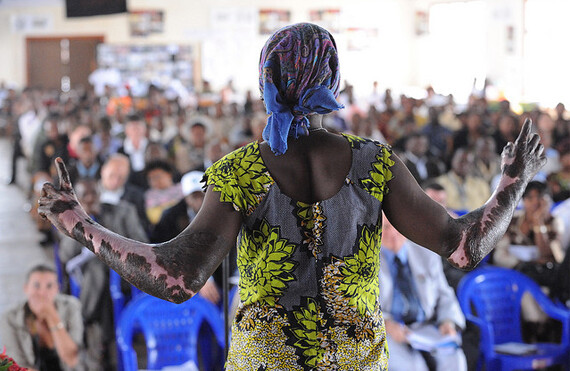 CREDIT: <a href="http://www.flickr.com/photos/julien_harneis/2858287885/in/pool-democraticrepublicofcongo/">Julien Harneis</a> (<a href="http://creativecommons.org/licenses/by-sa/2.0/deed.en">CC</a>).